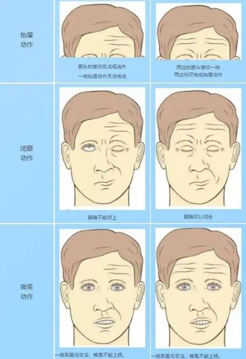 dede 面部不居中