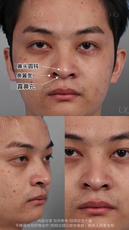 dede 面部不居中